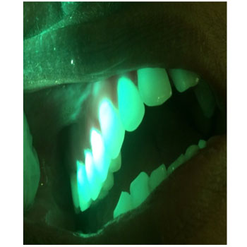 MicrosoftTeams-image (19)